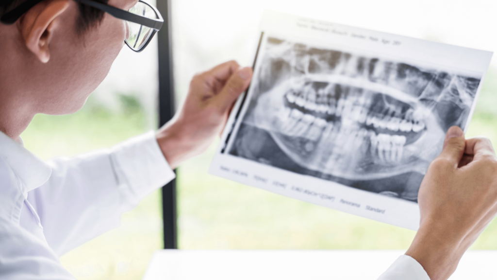 8 Signs That You Need Dental Implants